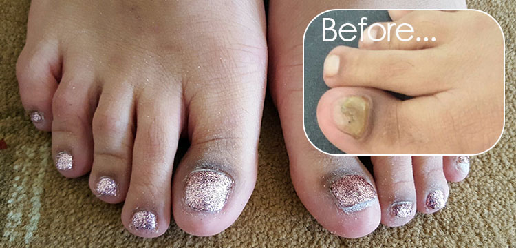 Long Fake Toenails Are Trendy Now And At This Point There Are No Words